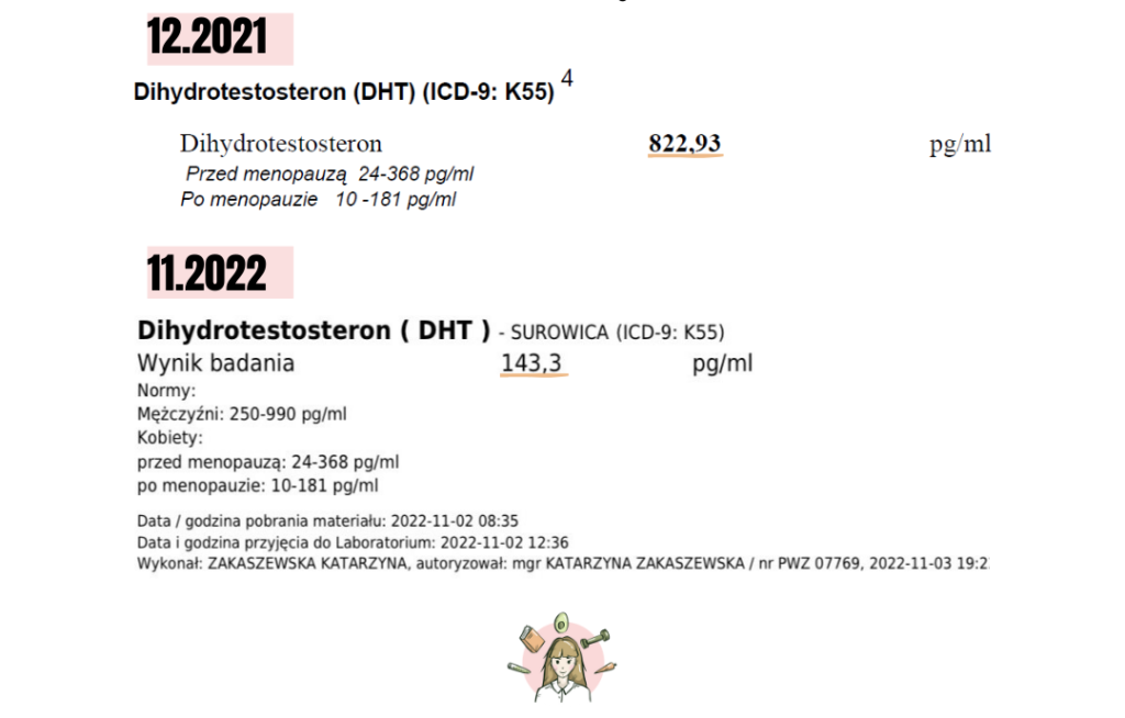 trądzik - DHT